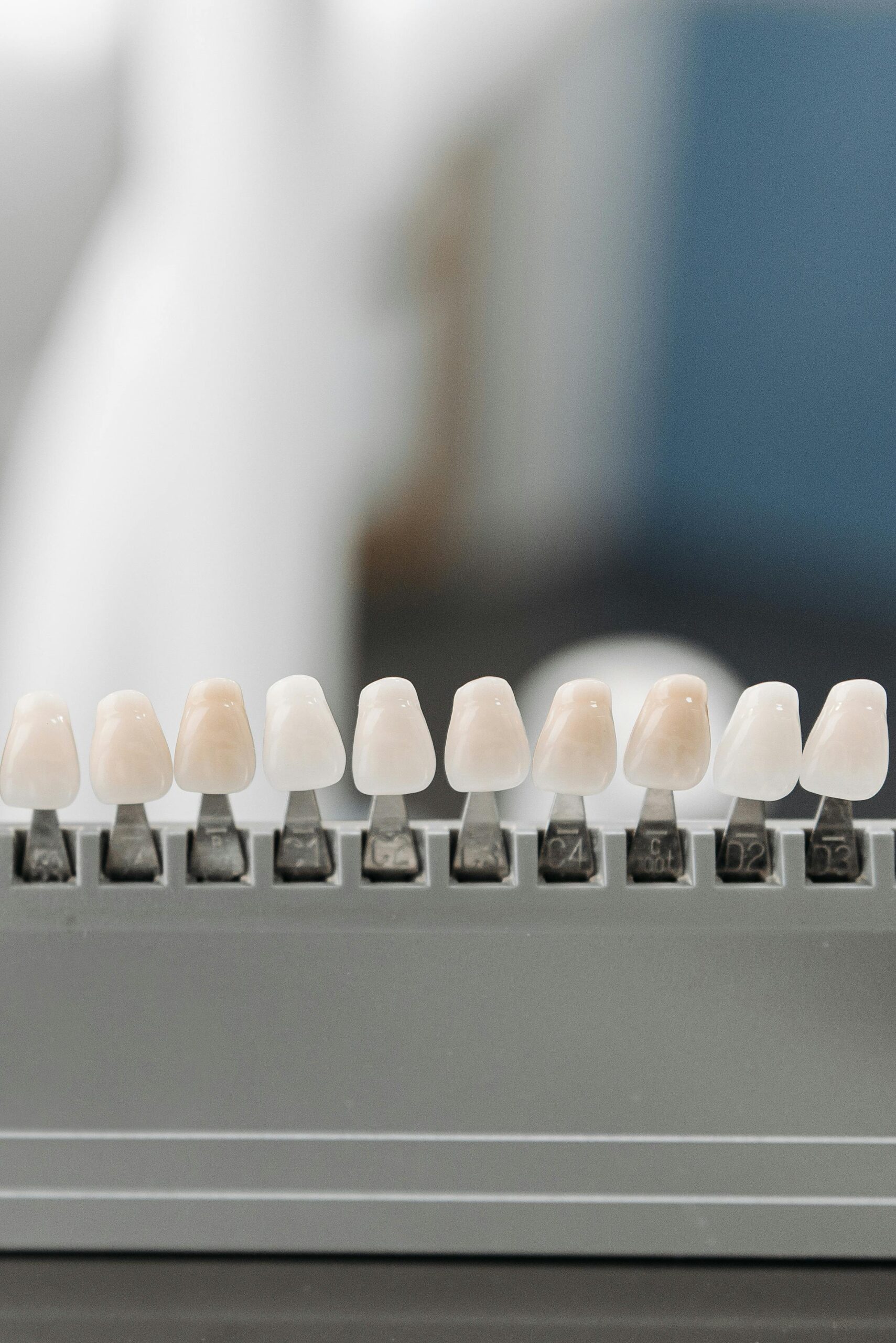 Estética dental y diseño de sonrisa